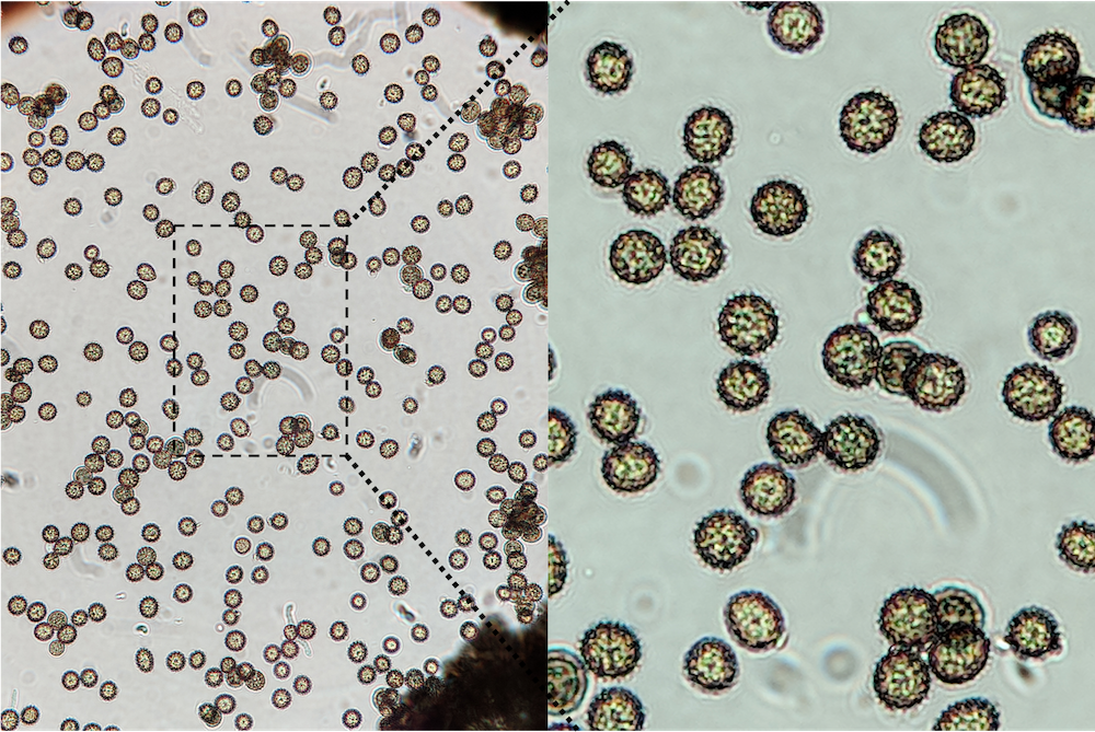 Ustilago Maydis Figure 2